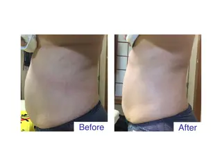 子宮矯正/腸揉み/ シュガーリング脱毛のエステ・リラクイメージ