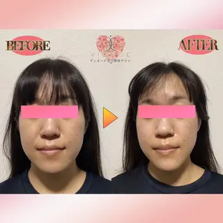 ヴィオーデ美容 整体サロン 立川店のエステ・リラクイメージ