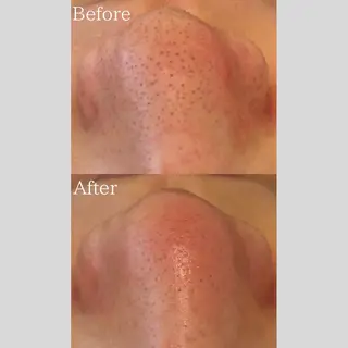 韓国肌管理 【毛穴専科】のエステ・リラクイメージ