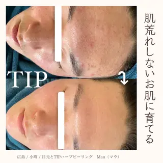 Mau beauty salon所属・Mau (マウ)のエステ・リラクイメージ