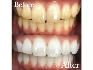 LBSホワイトニング 🌐渋谷店 公式のエステ・リラクイメージ