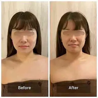 眉毛×小顔矯正サロン パピヨンsakiのエステ・リラクイメージ