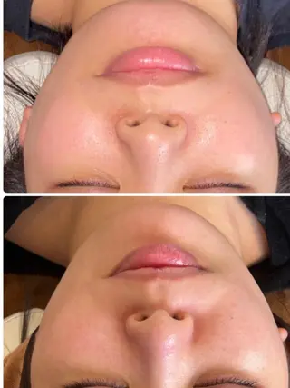 ■超絶小顔&肌管理室■所属・🦋整形級の究極美顔 本格韓国式小顔🦋のエステ・リラクイメージ