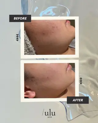 /ulu  soin所属・太田 玲奈のエステ・リラクイメージ