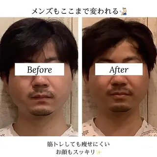 小顔専門☠️ 筋膜/脂肪/毛穴洗浄のエステ・リラクイメージ