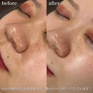 アイブロウ 三戸部 まどかの眉毛・アイブロウイメージ