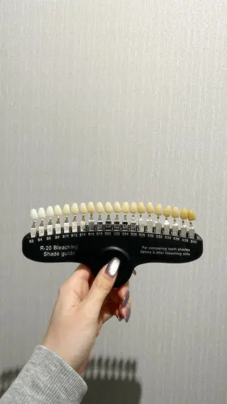 セルフホワイトニングサロンMUSE所属・セルフホワイトニング MUSE🫧焼津のその他イメージ