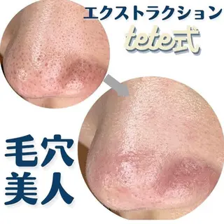 毛穴ケア専門サロン Yourmeユアミーのエステ・リラクイメージ