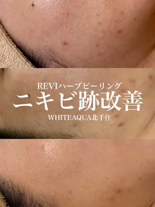 WHITE AQUA 北千住店のエステ・リラクイメージ