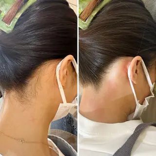 うなじ脱毛/美肌脱毛 LABELのエステ・リラクイメージ