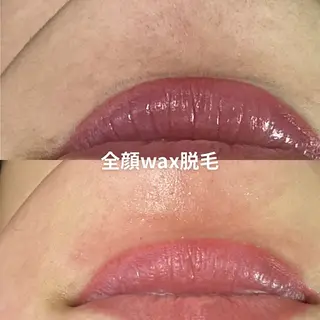 EST BEAUTY所属・顔専門ワックス脱毛/ ハーブピーリングのエステ・リラクイメージ