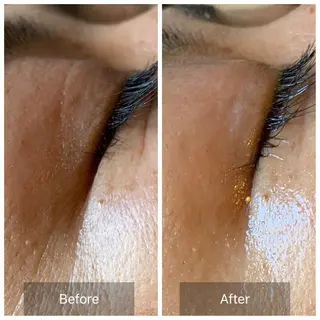 Mandarin Orange所属・毛穴から始める肌メン テマンダリンオレンジのエステ・リラクイメージ