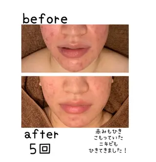 癒し腸もみサロン シャユーム　ゆきなのエステ・リラクイメージ