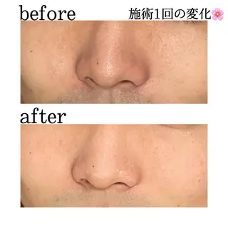 触れたくなる モテ肌へ...❤︎のエステ・リラクイメージ