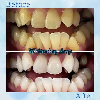 メンズ ホワイトニング ショップ葛西店のその他イメージ