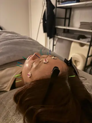 美容鍼×小顔矯正 ×美容整体 浜川泰仁のエステ・リラクイメージ