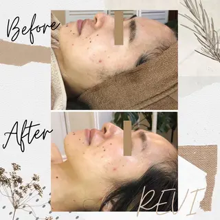 温活beautyサロンNeroli所属・切らない脂肪吸引🔥 Neroliまりこのエステ・リラクイメージ