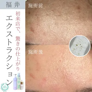 毛穴ケア専門サロン Yourmeユアミーのエステ・リラクイメージ