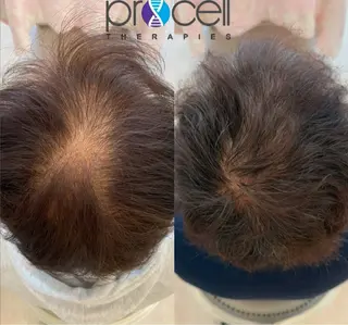 メンズ Blooming所属・LOUISE. ／肌質・頭皮のエステ・リラクイメージ