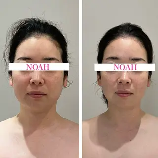 NOAH 小顔毛穴 川越店所属・NOAH ORIEのエステ・リラクイメージ