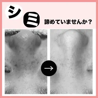 脱毛&フェイシャル 専門店muro.のエステ・リラクイメージ