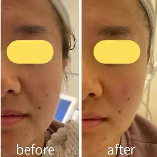 マツエク・マツパ aliaハイフ&水光ジェットサロン所属・aliaハーブ水光店 エステティシャン募集のエステ・リラクイメージ