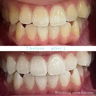 セルフホワイトニングサロンfascimo所属・ホワイトニングサロン fascimo新座店のその他イメージ