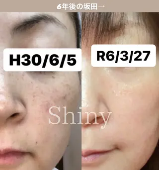 Shiny所属・✨ナリス化粧品✨ Shinyのエステ・リラクイメージ