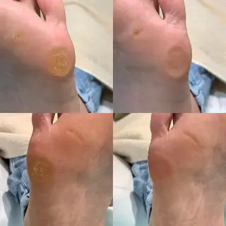 東京巻き爪アカデミー所属・東京巻き爪 アカデミーのエステ・リラクイメージ