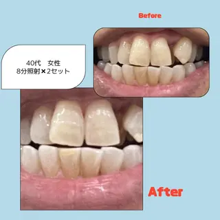 ホワイトニングサロン プレジールのエステ・リラクイメージ