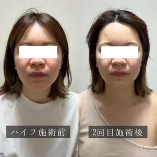 脱毛専門サロン BELFINE恵比寿のエステ・リラクイメージ