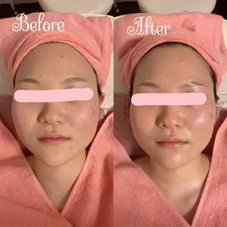 透明感の肌Lino malieのエステ・リラクイメージ