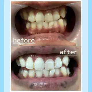 メンズ お手軽ホワイトニングsalon mina所属・武元 奈津美のその他イメージ