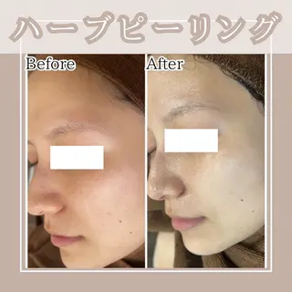 メンズ キッズ Amaryllis 🌹松本のエステ・リラクイメージ