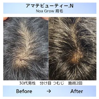 メンズ ショート 痩身小顔専門 アマテ ビューティー.Nのエステ・リラクイメージ
