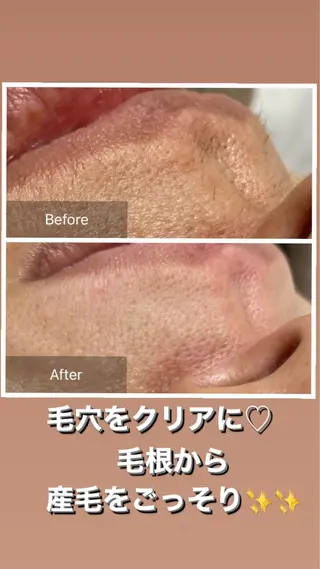 産毛専門店 Bittoのエステ・リラクイメージ