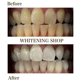 ホワイトニングショップ静岡葵区店所属・ホワイトニング ショップ静岡葵区店のその他イメージ