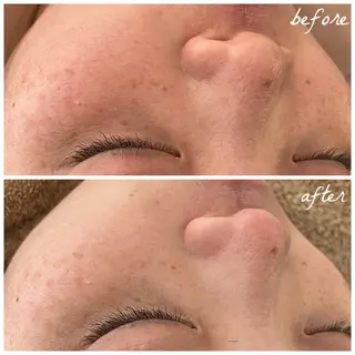 メンズ メナード岐阜茜部 杉浦のエステ・リラクイメージ