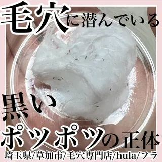 毛穴専門店hula 杉山智美のエステ・リラクイメージ