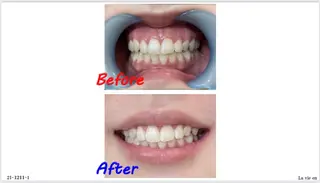 セルフホワイトニングサロン　ラヴィアン所属・ホワイトニングサロン La vie enのその他イメージ