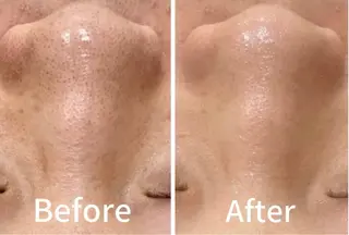 Rapport ラポールのエステ・リラクイメージ