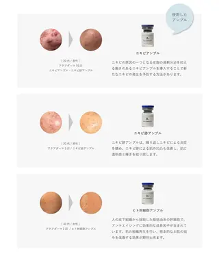 看護師が施術する美容 ナスサロ/川口のエステ・リラクイメージ