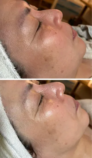 esty hitomiのエステ・リラクイメージ