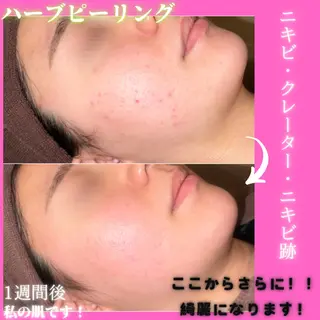 痩身&美肌サロン 堀米✨のエステ・リラクイメージ
