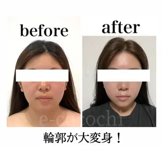 小顔と ヘッドスパのお店のエステ・リラクイメージ