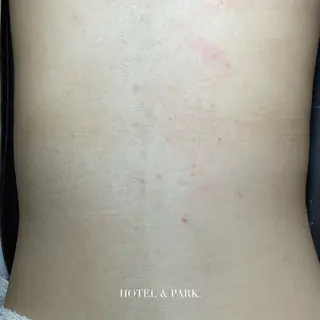 HOTEL&PARK . ワックス脱毛のエステ・リラクイメージ