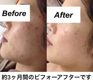 都度払い肌質改善 &脱毛Blancheのエステ・リラクイメージ