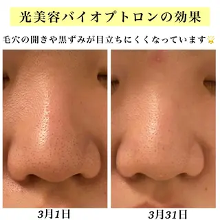 Bellesthe （ベルエステ）のエステ・リラクイメージ