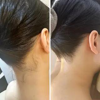 うなじ脱毛/美肌脱毛 LABELのエステ・リラクイメージ