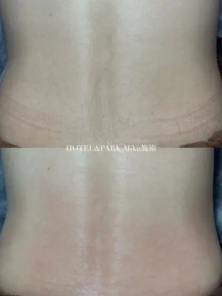 HOTEL&PARK Mikuワックス脱毛のエステ・リラクイメージ